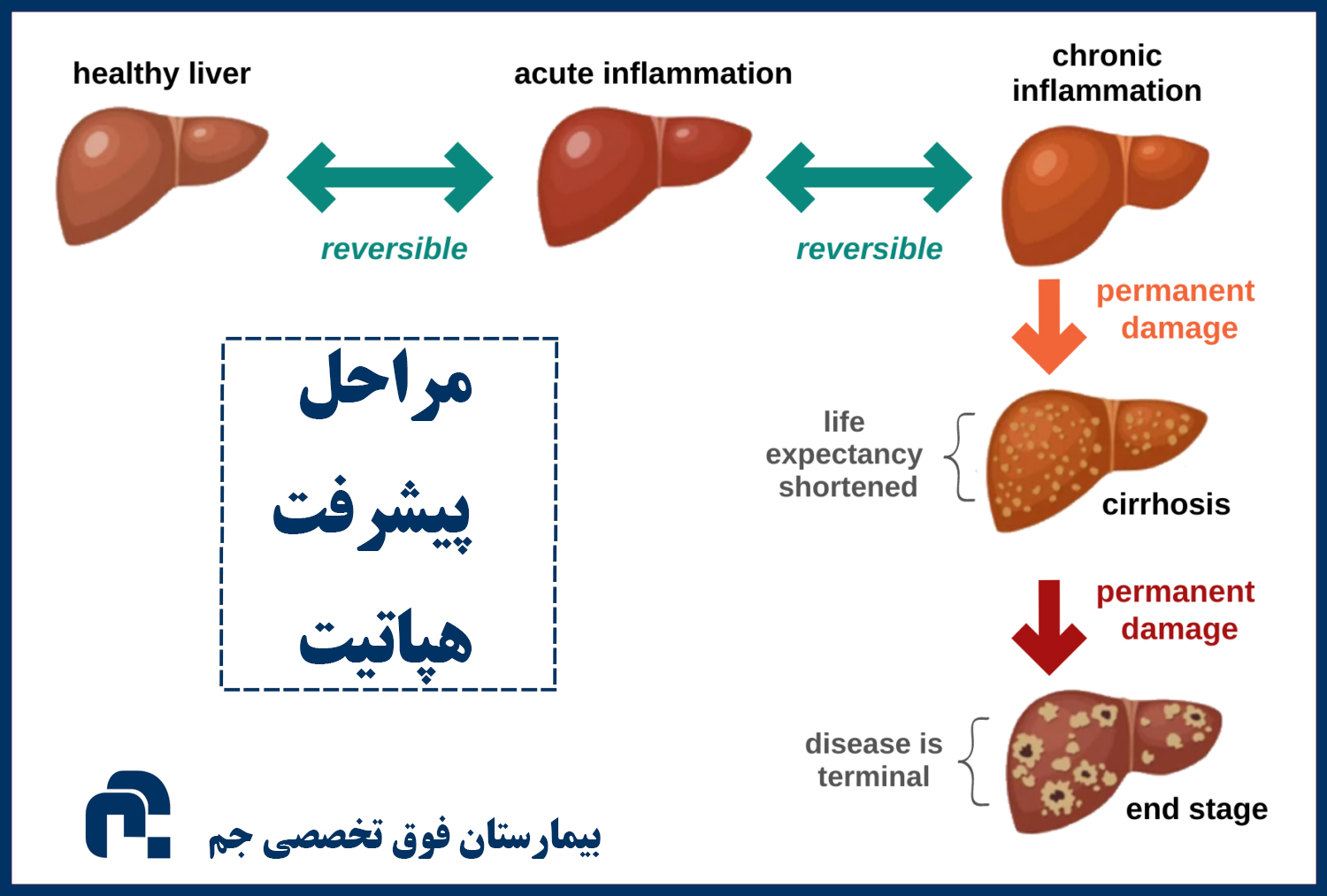 بیماری هپاتیت