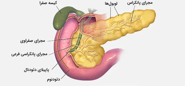 التهاب_پانكراس