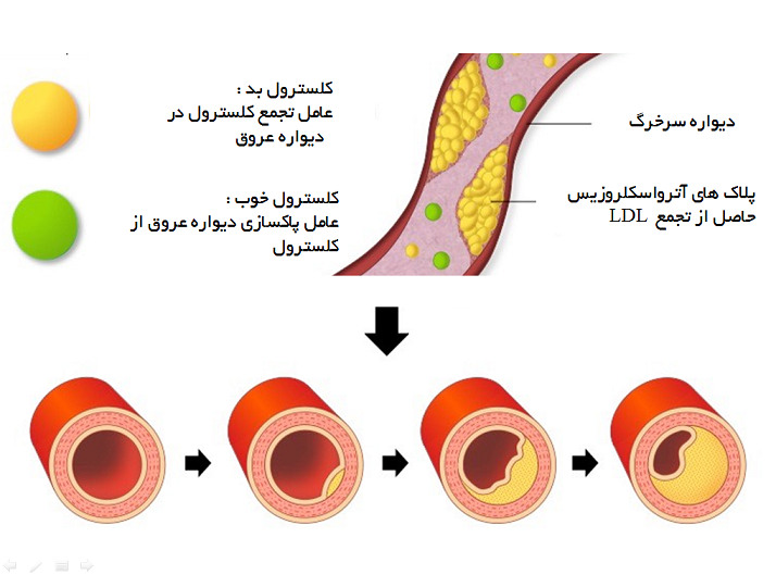 چربی خون بالا