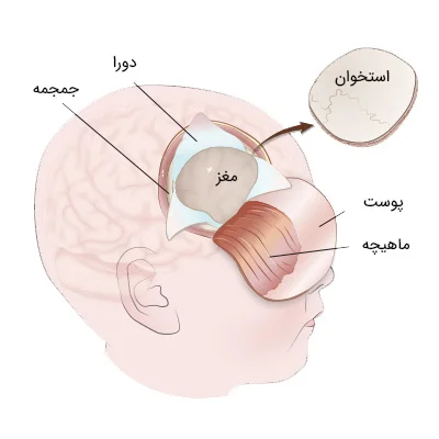 ترومای سر و جراحی مغز